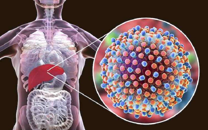 نارسایی کبدی، سیروز و سرطان کبد از عوارض بیماری هپاتیت B مزمن