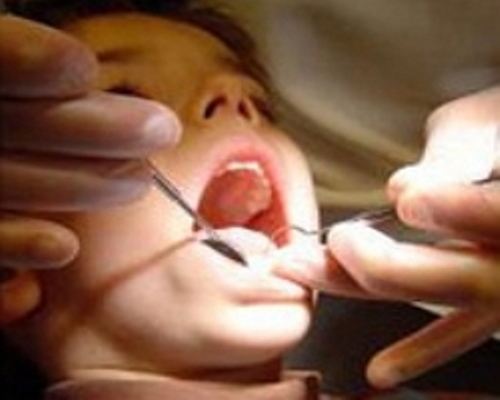کارشناس مسئول بهداشت دهان و دندان مرکز بهداشت بجنورد: اعزام 11 گروه دنداپزشکی به مناطق محروم بجنورد
