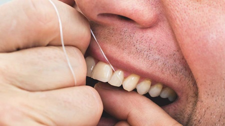 اهمیت استفاده از نخ دندان به منظور پیشگیری از پوسیدگی دندانی