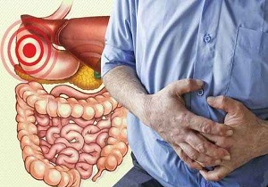 التهاب روده ها و بیماری سلیاک دو عامل موثر در یبوست