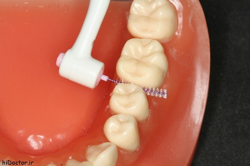 نکات جدید بهداشت دهان و دندان