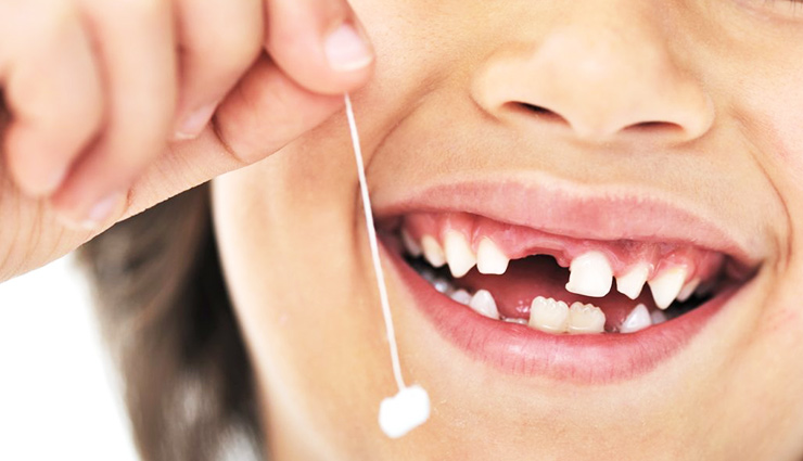 مراقبت از دندان های شیری را جدی بگیرید