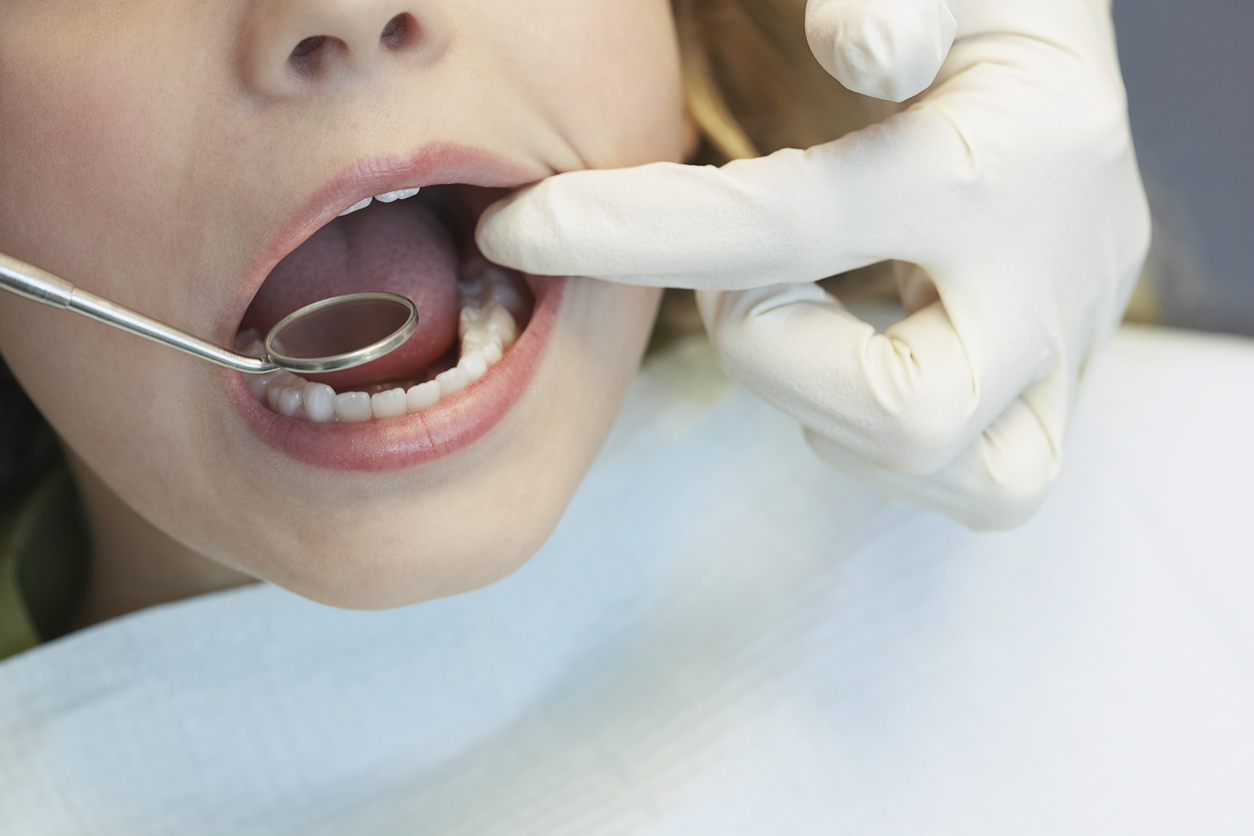 تغییرات هورمونی در دوران بارداری عامل مهم پوسیدگی دندان